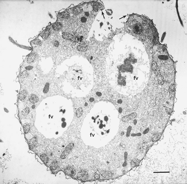 Food Vacuoles